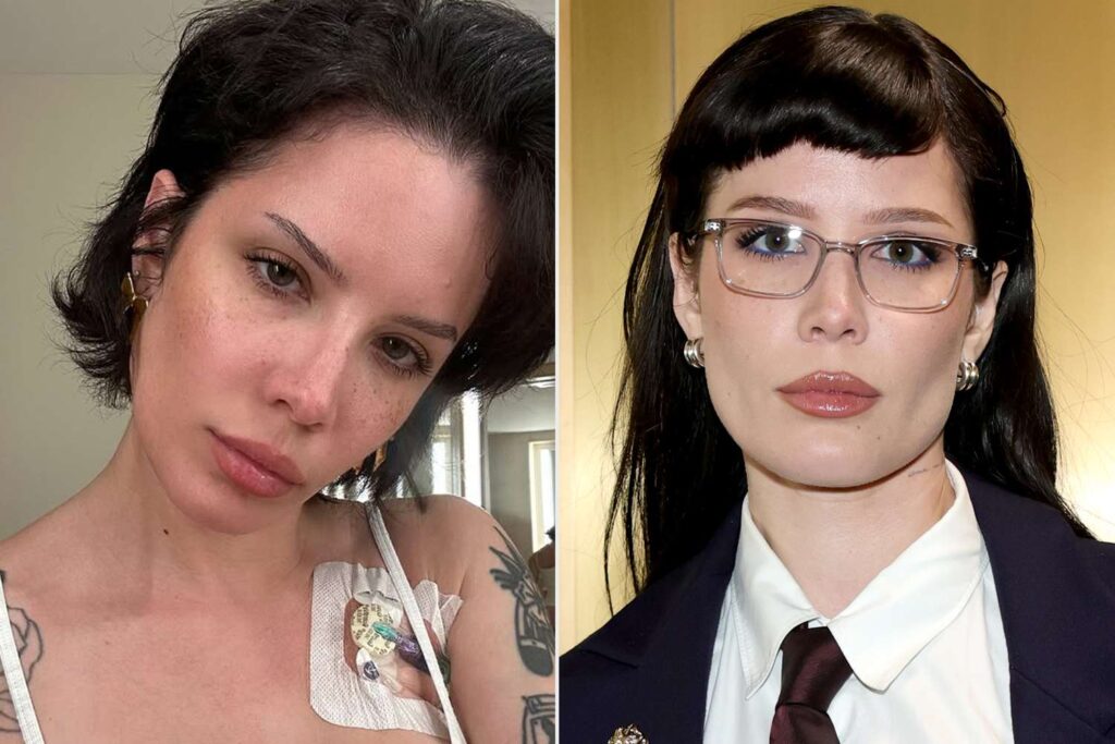 Halsey muestra su puerto médico en un selfie sincero durante tratamiento hospitalario