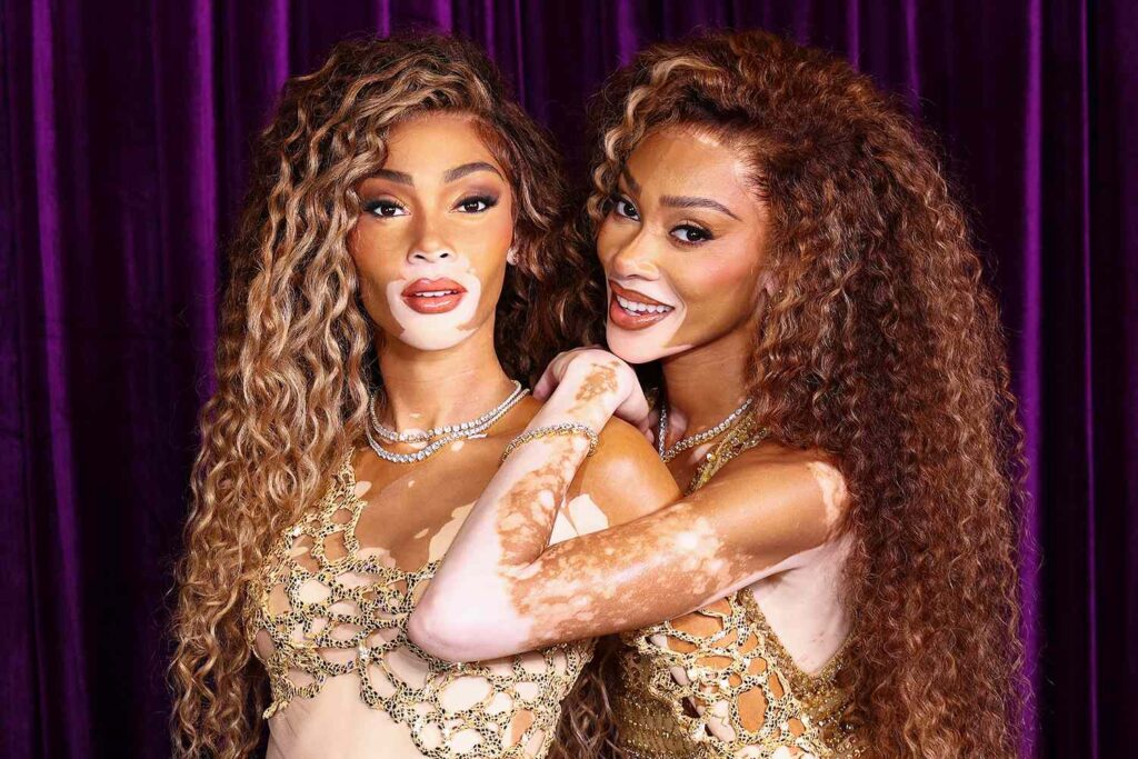 Winnie Harlow presenta su figura de cera en Madame Tussauds en el Día Mundial del Vitiligo