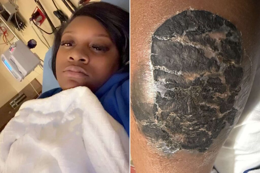 Tatuaje en Honor a su Hermano: Una Experiencia que la Llevó a la UCI