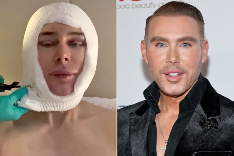 Kristofer Buckle, el Artista de Maquillaje de Celebridades, Muestra Impactantes Fotos del Antes y Después de Cirugías Estéticas